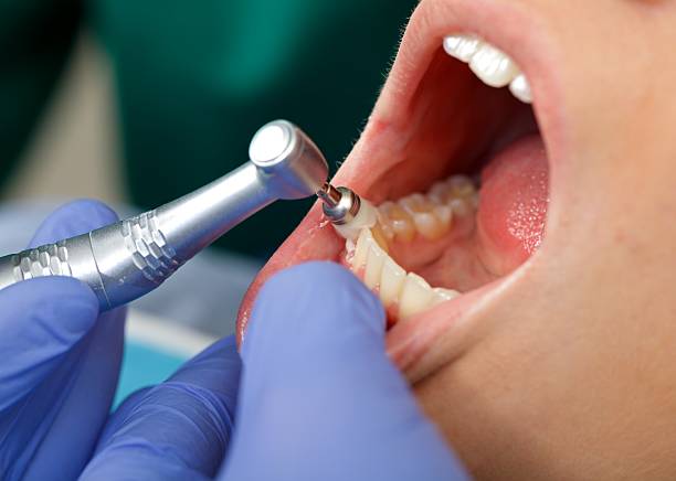 Oral Surgery in Duncan, SC